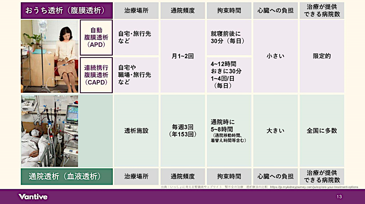 透析方法の比較